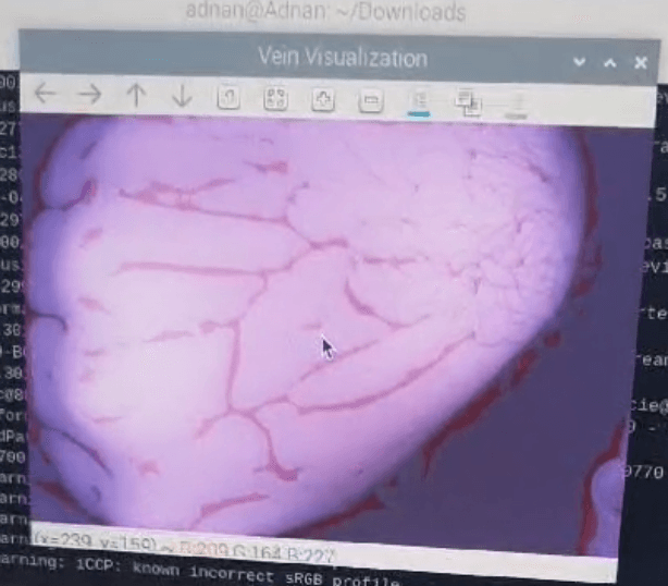 Vein Visualizer